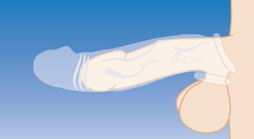 Size Matters - Clear Extender gekrümmte Penis-Hülle